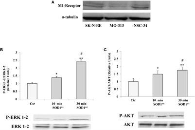 Effect of Mutated Cu, Zn Superoxide Dismutase (SOD1G93A) on Modulation of Transductional Pathway Mediated by M1 Muscarinic Receptor in SK-N-BE and NSC-34 Cells